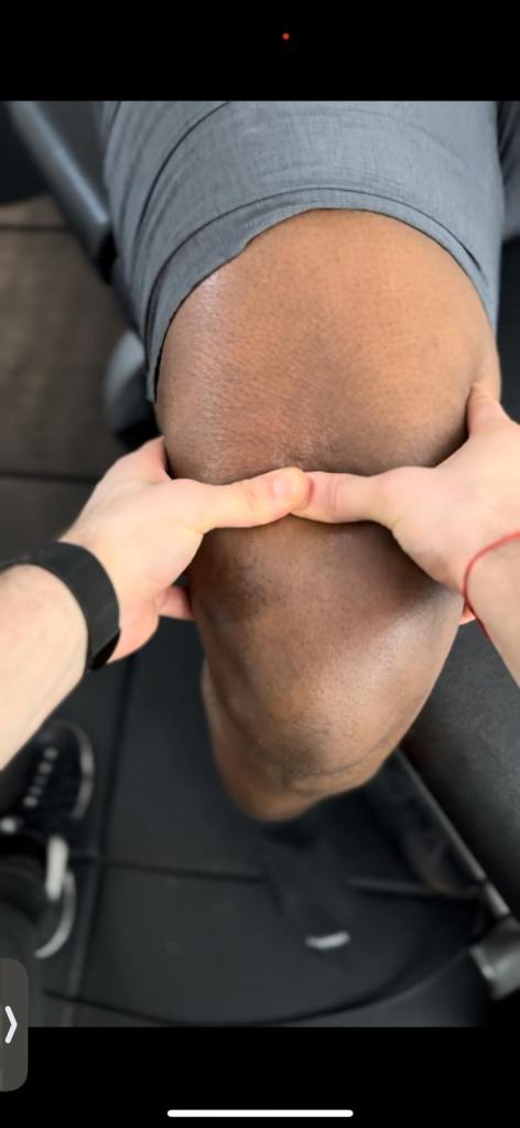 Manhattan sports physical therapy