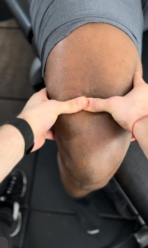 Manhattan sports physical therapy